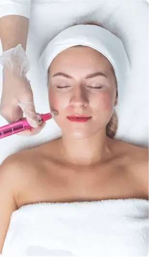 Microneedling Treatment in Costa Mesa CA