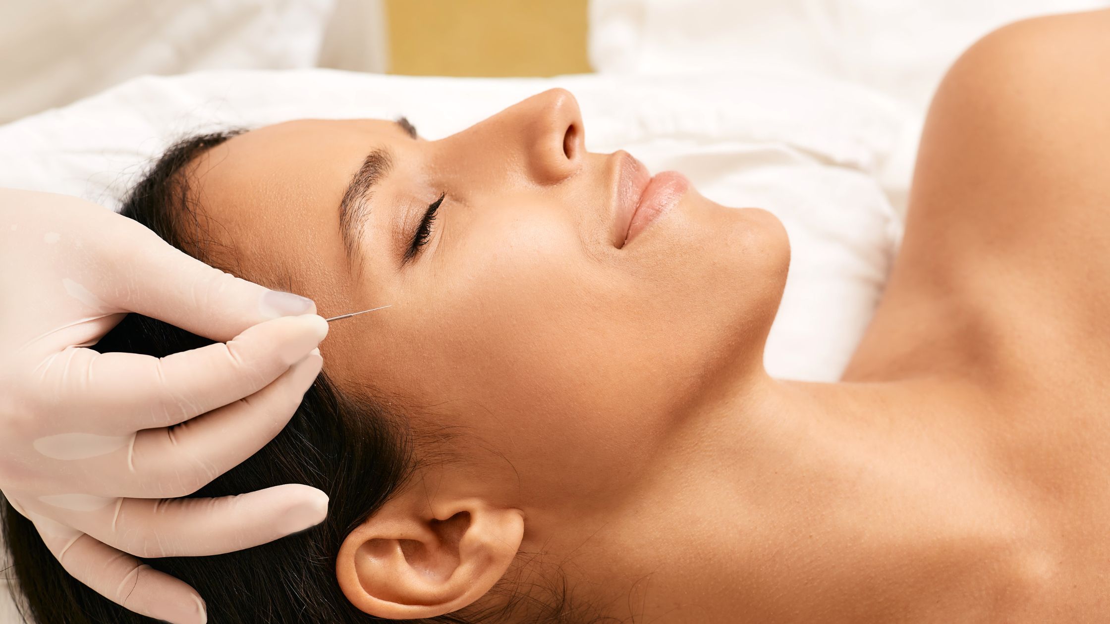 How Cosmetic Acupuncture Works