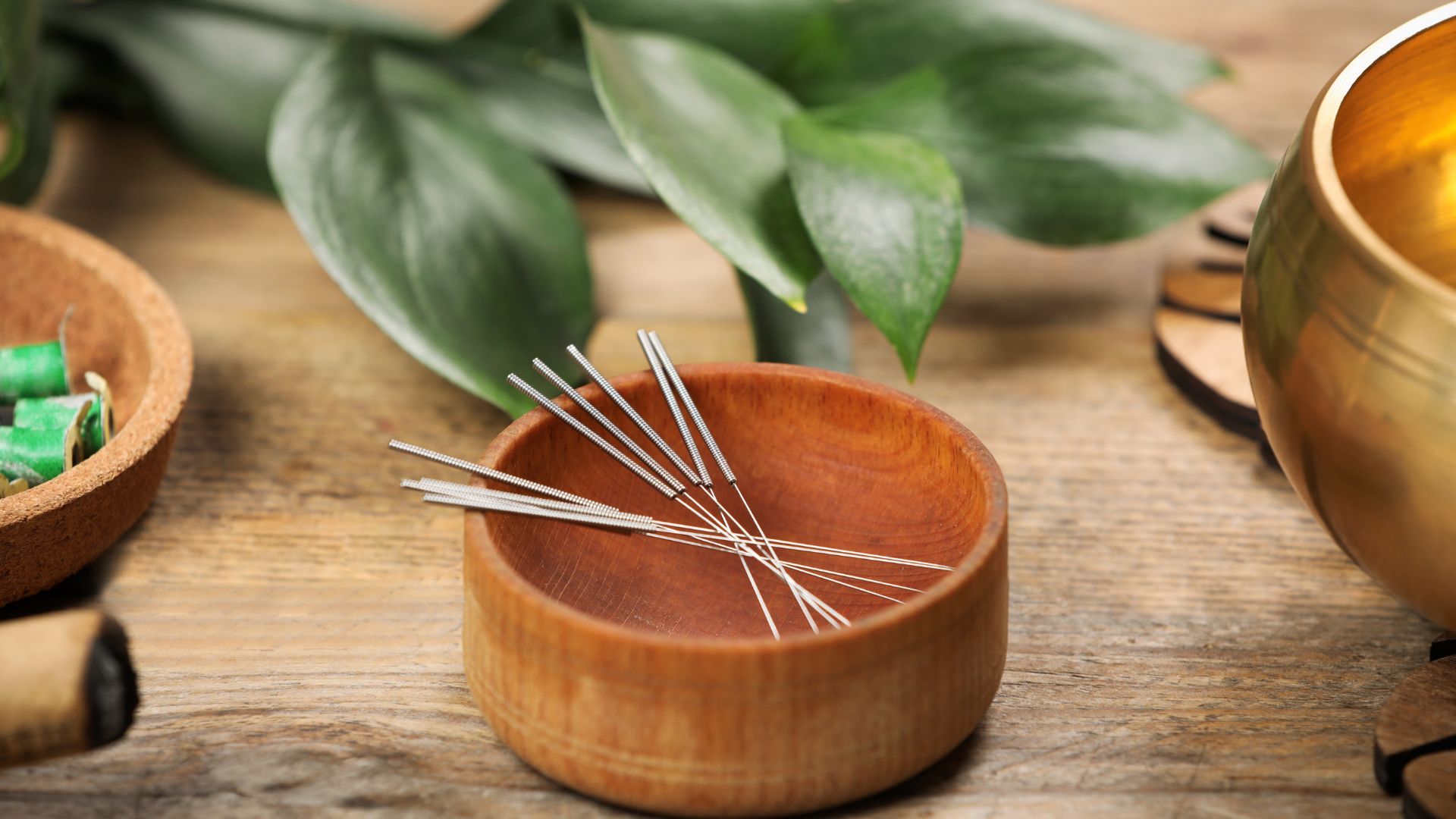 Acupuncture treatment in Costa Mesa for stress and anxiety relief – calming clinic setting with fine acupuncture needles placed to promote relaxation and mental wellness.